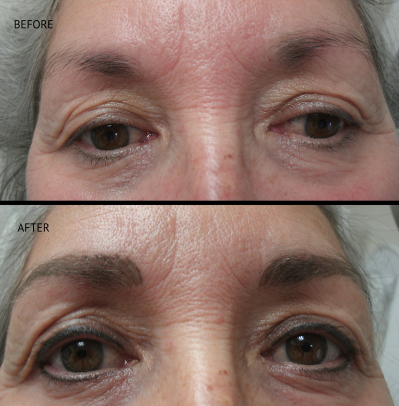   Permanent Eyebrows in Eau Claire, Wisconsin