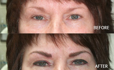   Permanent Eyebrows in Eau Claire, WI