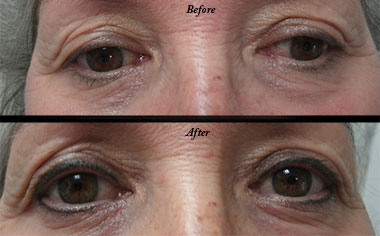   Permanent Makeup in Eau Claire, WI